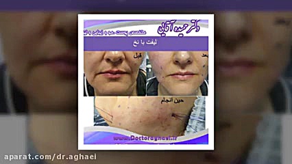 نمونه کارهای دکتر حمیده اقایی متخصص پوست و مو و زیبایی دکتر حمیده آقایی