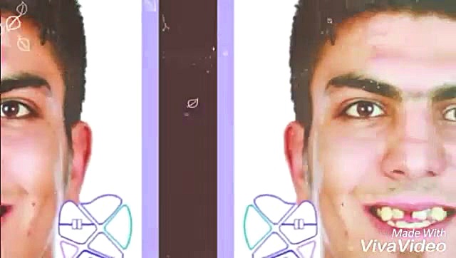 ارتودنسی و کاشت دندان دکتر علیرضا خدیوی