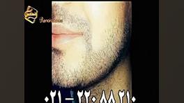 کاشت ریش و سبیل به روش SUT مرکز مو رنسانس اولتراسوند پرتابل جیبی