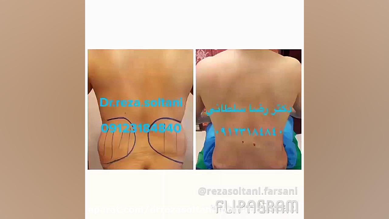 جدید ترین ،پیشرفته ترین و سریعترین دستگاه برای لاغری دکتر رضا سلطانی