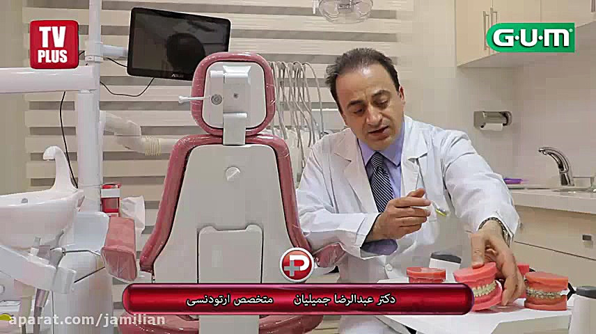 دستگاهای ارتودنسی دکتر عبدالرضا جمیلیان - متخصص ارتودنسی