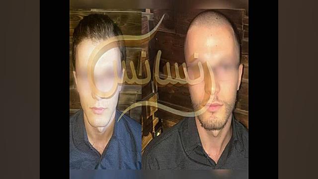 کاشت ریش و سبیل به روش SUT مرکز مو رنسانس ASO Test