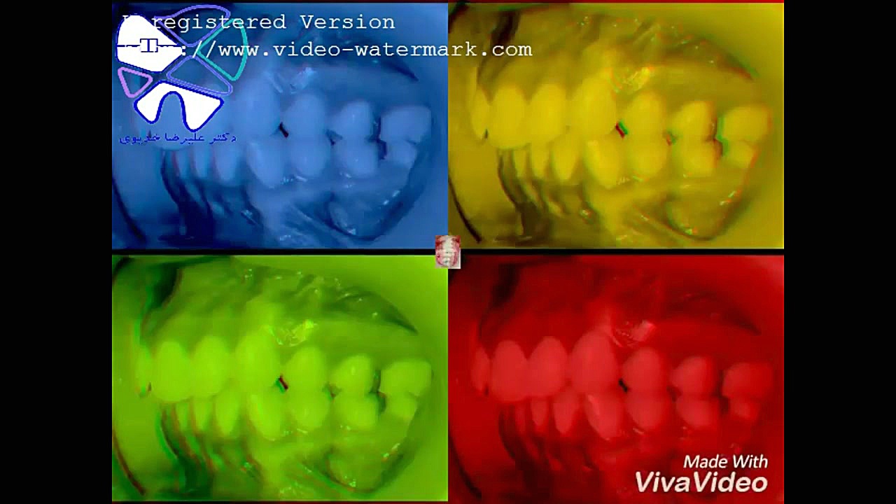 ارتودنسی و مراحل انجام آن دکتر علیرضا خدیوی