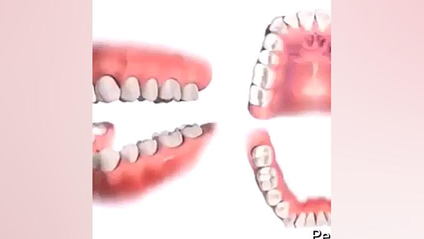درمانهای ارتدنسی همراه با كشیدن تعدادی از دندانهای دائم دکتر علیرضا خدیوی
