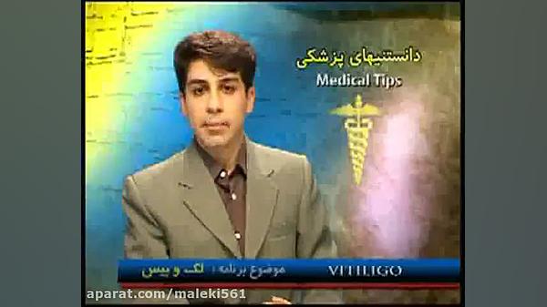 برنامه ای کوتاه درباره لک و پیس یا ویتیلیگو کمند امیرسلیمانی