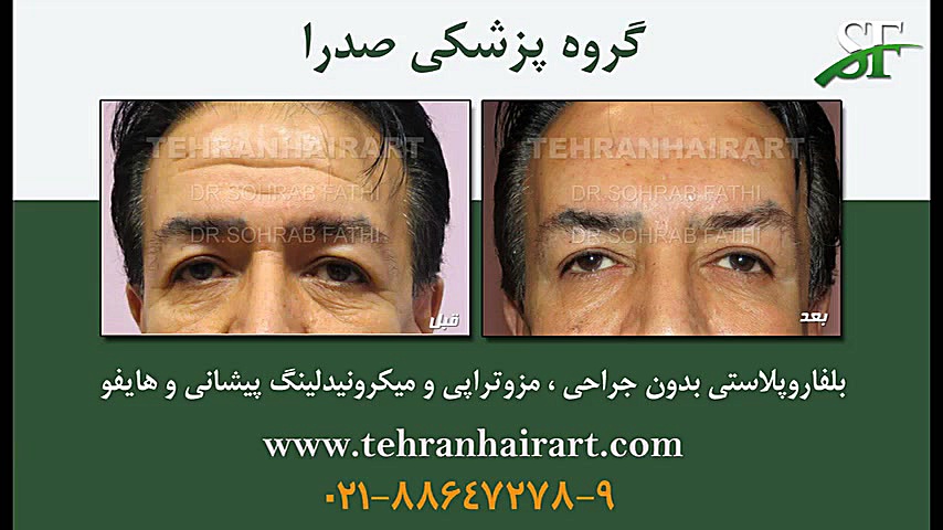 پلاسماجت پریودنتیکس