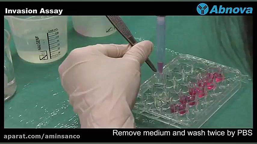 Invasion Assay مرغ قندی