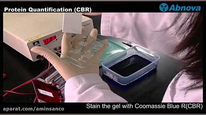 Protein Quantification Coomassie Blue R CBR جراحی زیبایی پلک