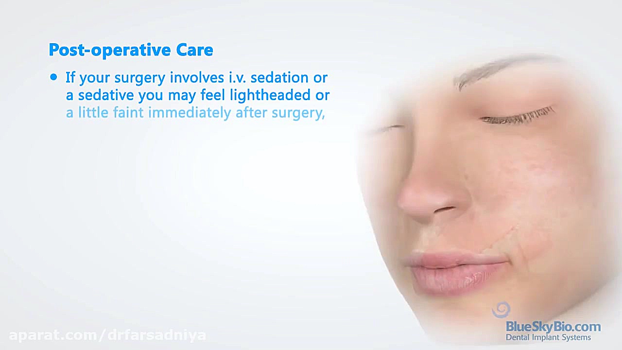 ایمپلنت چگونه کار میکند؟ دکتر فروزان فرسادنیا www.drfarsadniya.ir