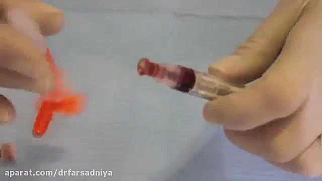 دندانپزشکی زیبایی- بلیچینگ دکتر فروزان فرسادنیا www.drfarsadniya.ir