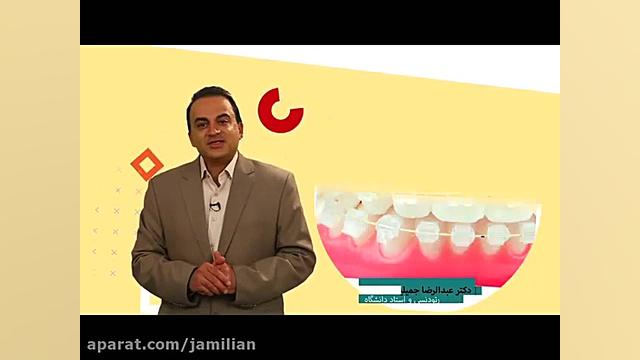 انواع ناهنجاری های فک و صورت دکتر عبدالرضا جمیلیان - متخصص ارتودنسی