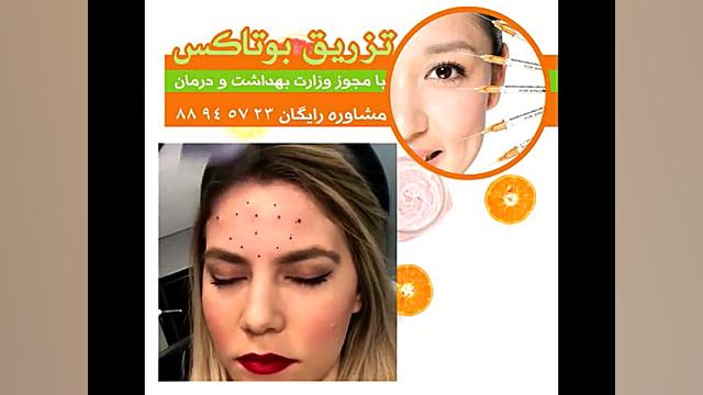 تزریق بوتاکس پر کردن دندان