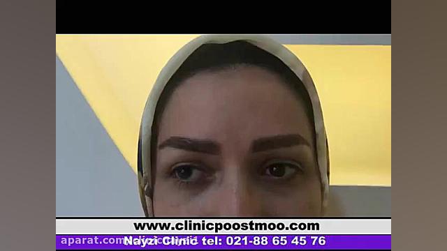درمانگاه تخصصی پوست،مو و لیزر "نای ذی" پر کردن دندان