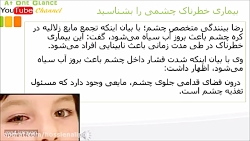 بیماری خطرناک چشمی را بشناسید