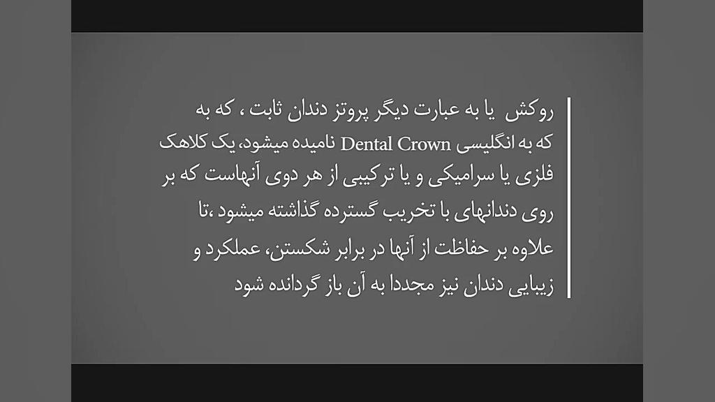 روکش دندان با 50% تخفیف! بررسی سطح اسید لاکتیک خون