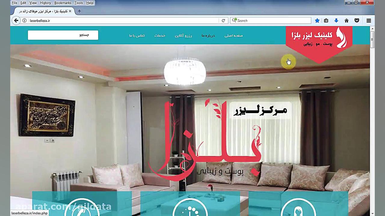 کلینیک بلزا , لیزر موهای زائد رشت لیزر موهای زائد