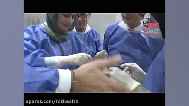 لیفت ابرو با نخ دابل نیدل هپی لیفت محصول پروموایتالیا دستگاه بیومتریک پوشیدنی