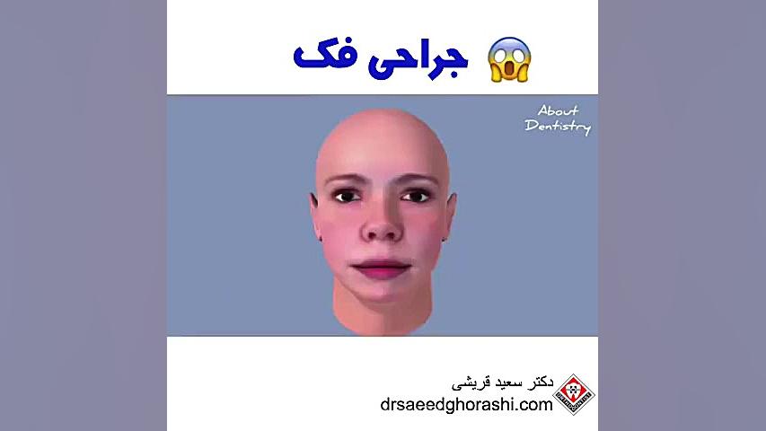 جراحی فک - دکتر سعید قریشی دکتر سعید قریشی