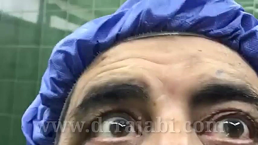بیرون زدگی ناگهانی در چشم آقای ۵۲ ساله رادیو اینترنتی
