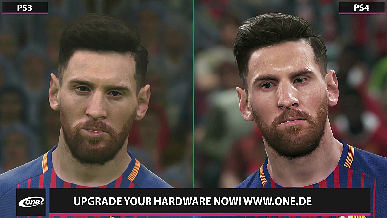 مقایسه گرافیک دموی بازی PES 2018 – PS3 vs PS4 جراحی لثه