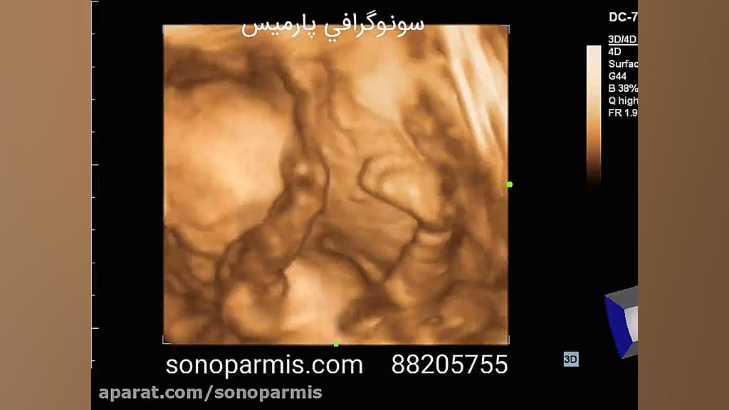پای جنین به صورت سه بعدی جعفر خوشخواب