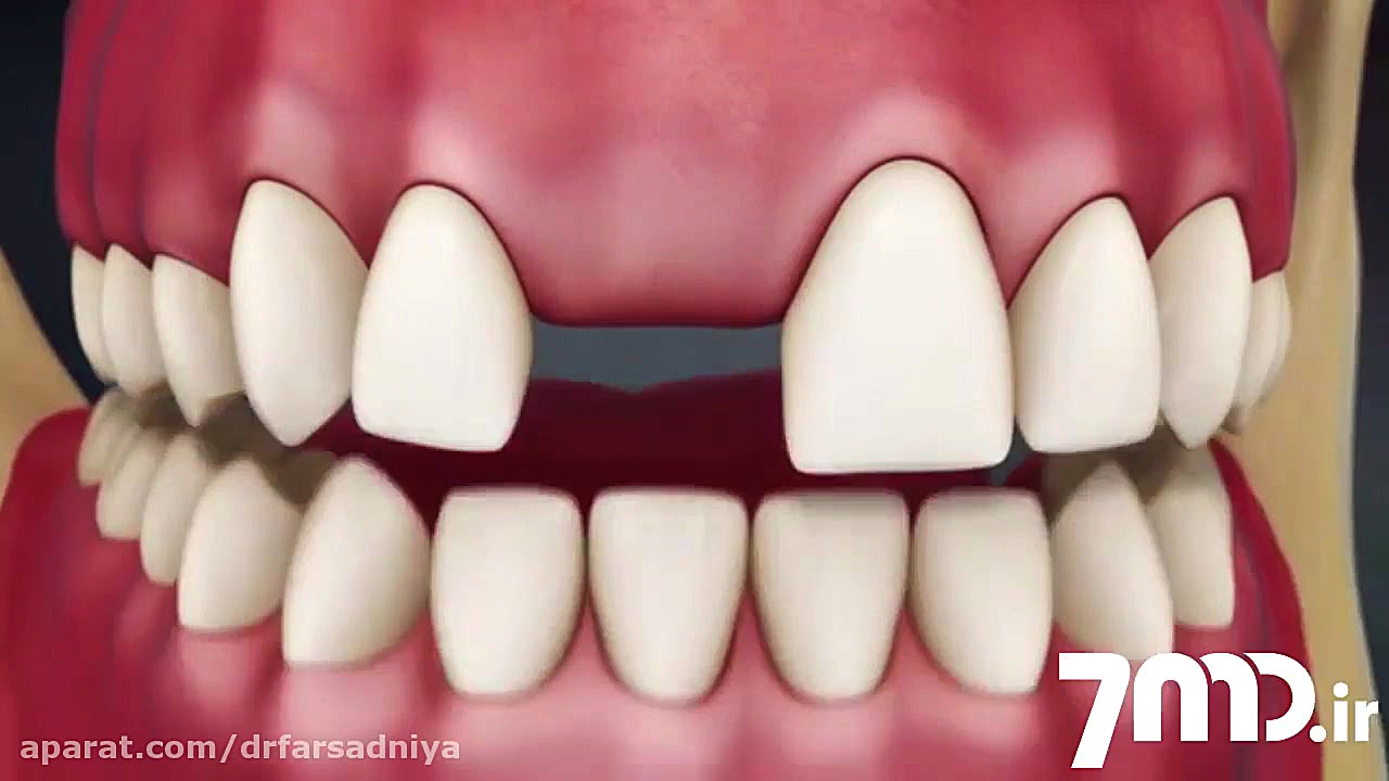 فیلم سالن انتظار دندانپزشکی - بریج دندان دکتر فروزان فرسادنیا www.drfarsadniya.ir