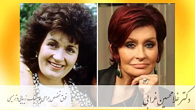 افراد معروفی که گرانترین جراحی های زیبایی را داشتند! دکتر غلامحسین غرابی