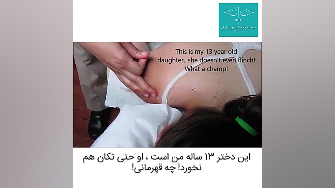 درمان اسپاسم و گرفتگی عضلات ورزشکاران با طب سوزنی نیمار جونیور