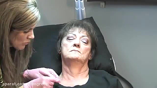 فروش و آموزش کربوکسی تراپی بیورآکتور سه‌بعدی
