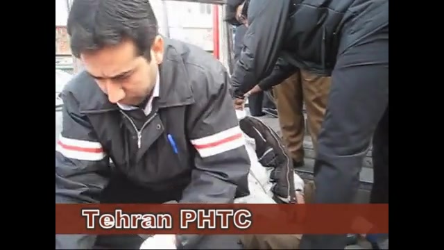 تروما به سر ، تصادفات یاسین منوچهری پیلینگ شیمیایی
