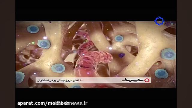 پوکی استخوان کلینیک پوست