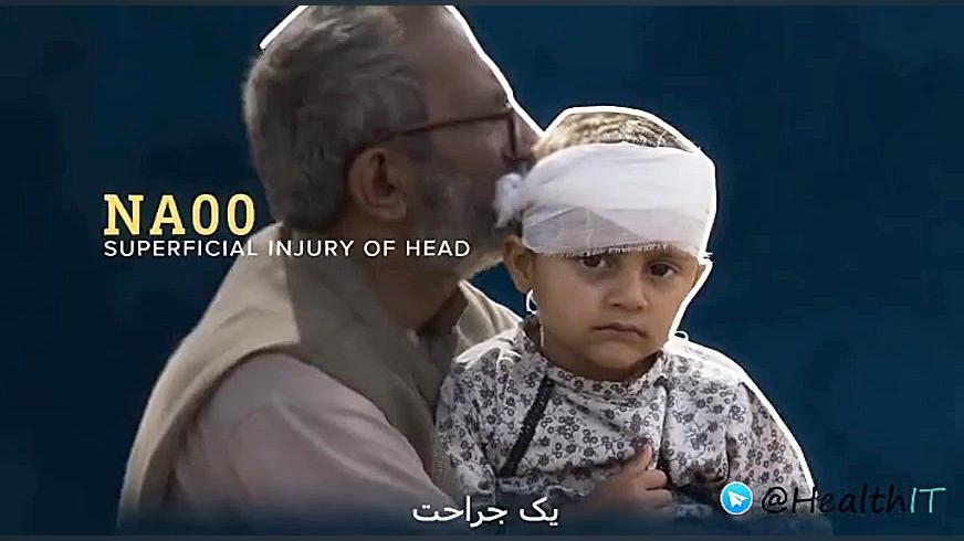 ICD 10 کنه وست
