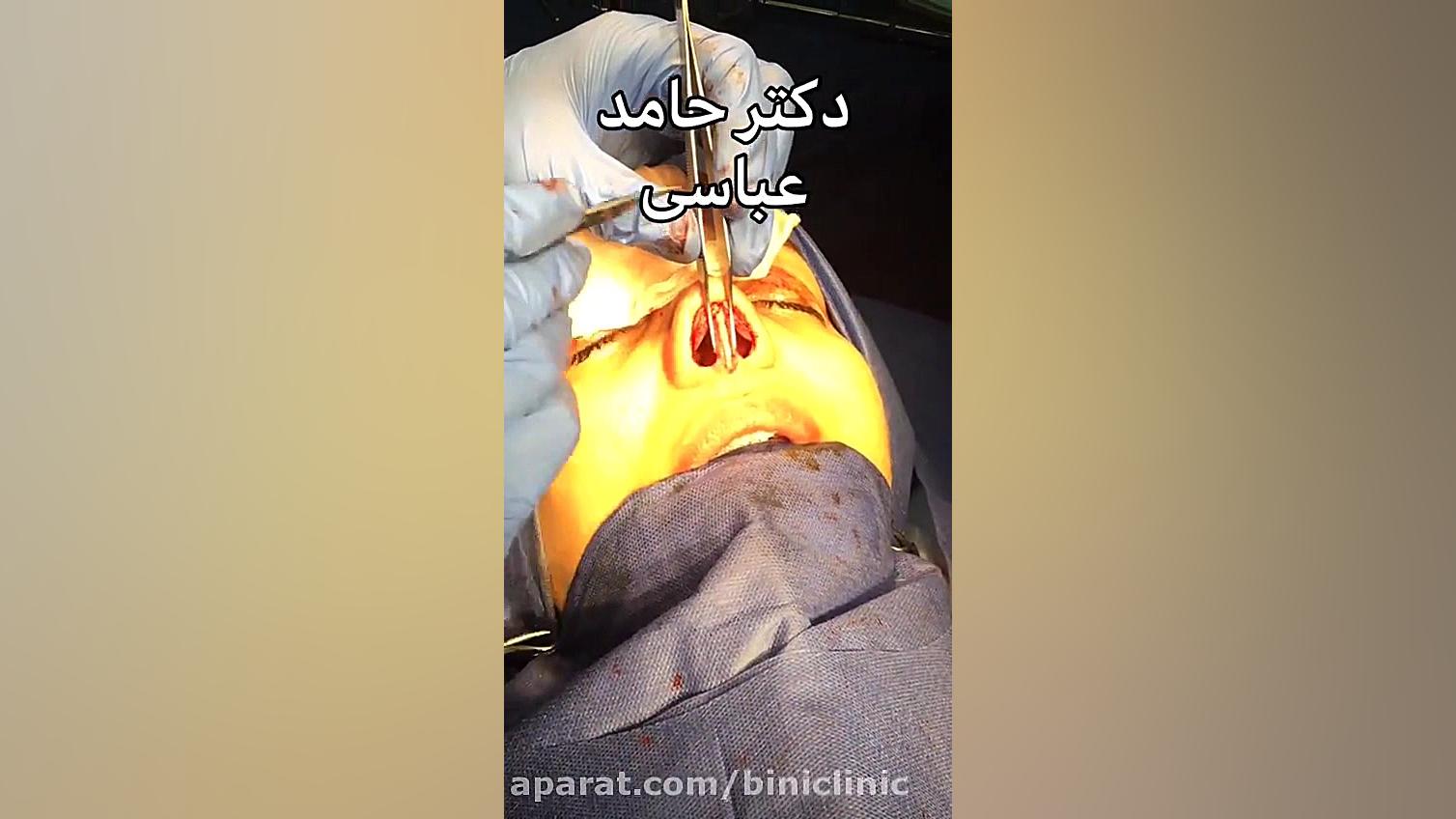 جراحی ترمیمی 3 دکتر حامد عباسی