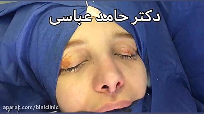 جراحی ترمیمی قسمت آخر دکتر حامد عباسی