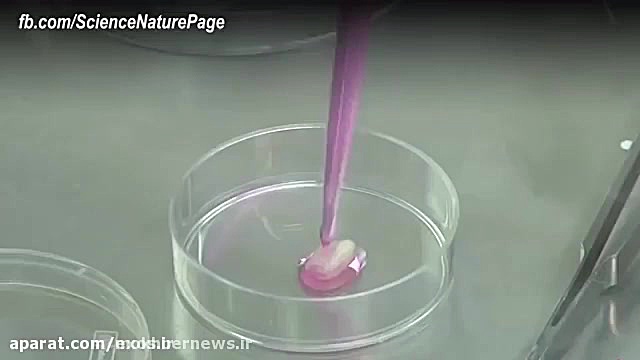 ترمیم دندان با استفاده از سلول های بنیادی بیماری گلوکوزامینوگلیکان تجمعی