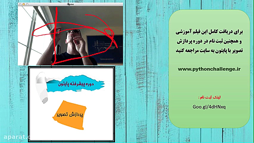درس هشتم : گرادیان و لبه یابی تصاویر (Edge Detection) بیماری سندرم فریمن شلدون