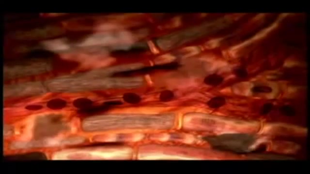 سکته قلبی چیست؟ - biology-helli5.ir جراحی گوش