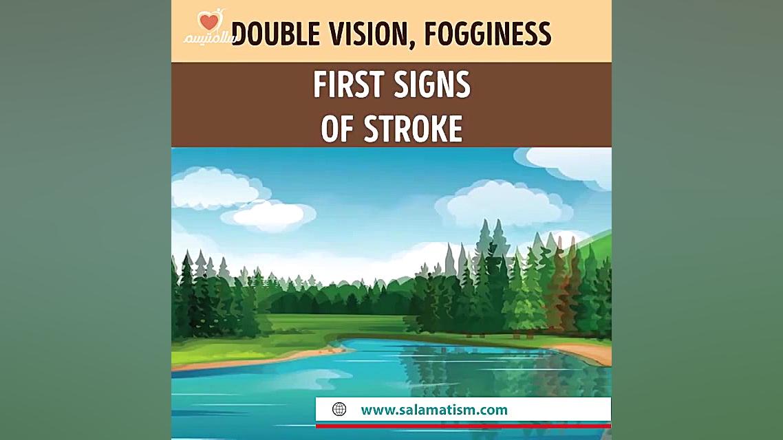 چشم درباره سلامتی چه می گوید؟ کلینیک زیبایی