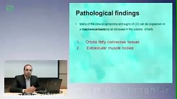 بیمارى تیرویید چشمى -قسمت اول