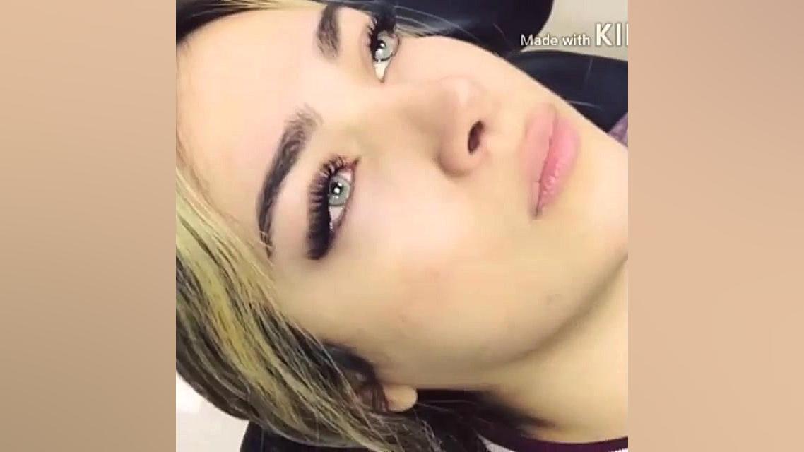 مرکز فوق تخصصی انواع کاشت و اکستنشن لیفت لمینت کراتینه رنگ مژه در کرج ارتودنسی