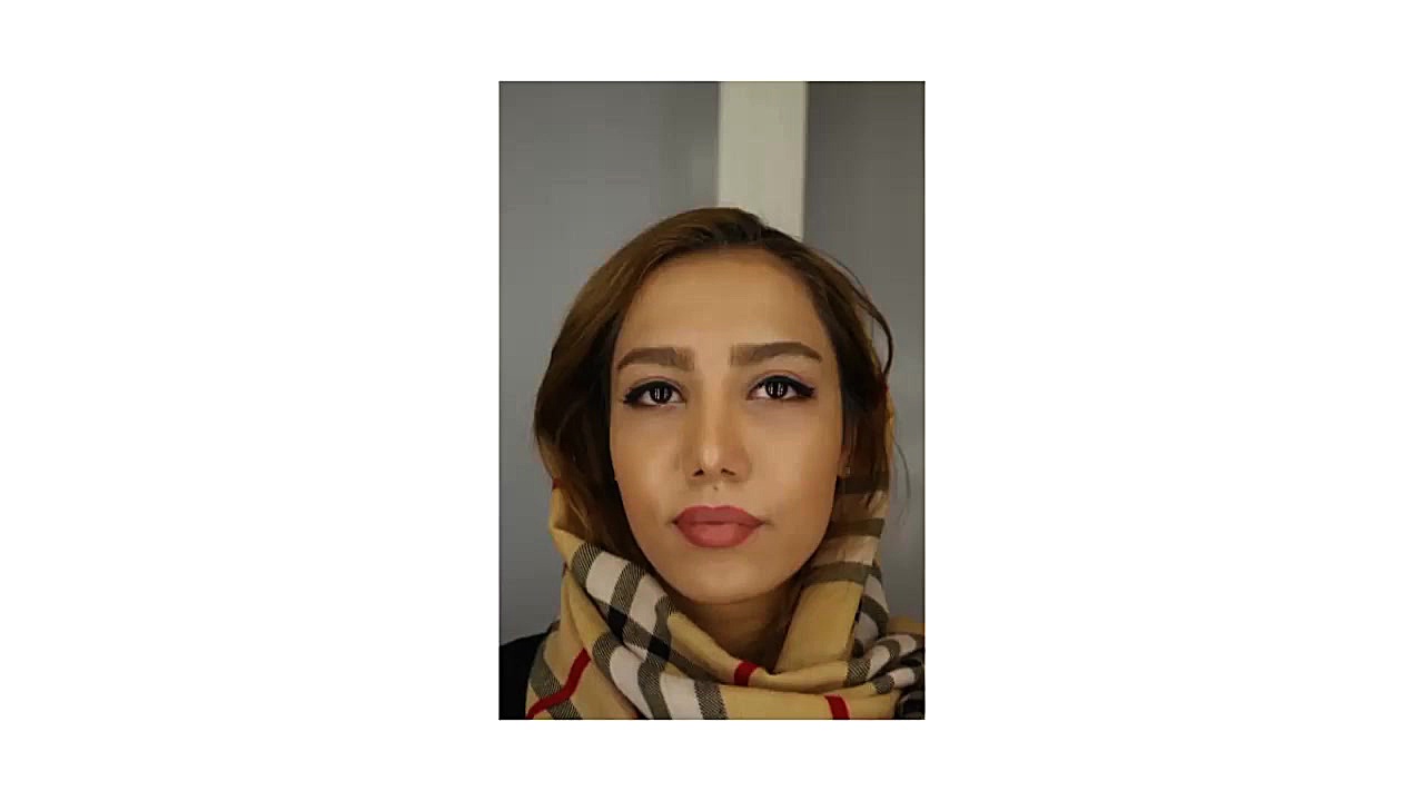 بهترین نتیجه جراحی بینی با روشی متفاوت لیفت ابرو
