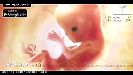 مرکز سونوگرافی تابناک پیلینگ