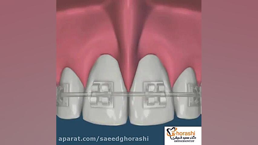 فرنکتوم- دکتر سعید قریشی دکتر سعید قریشی