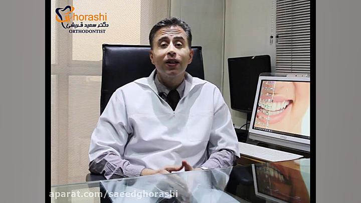 دستگاه باز کننده کام(اکسپندر)دکتر سعید قریشی دکتر سعید قریشی