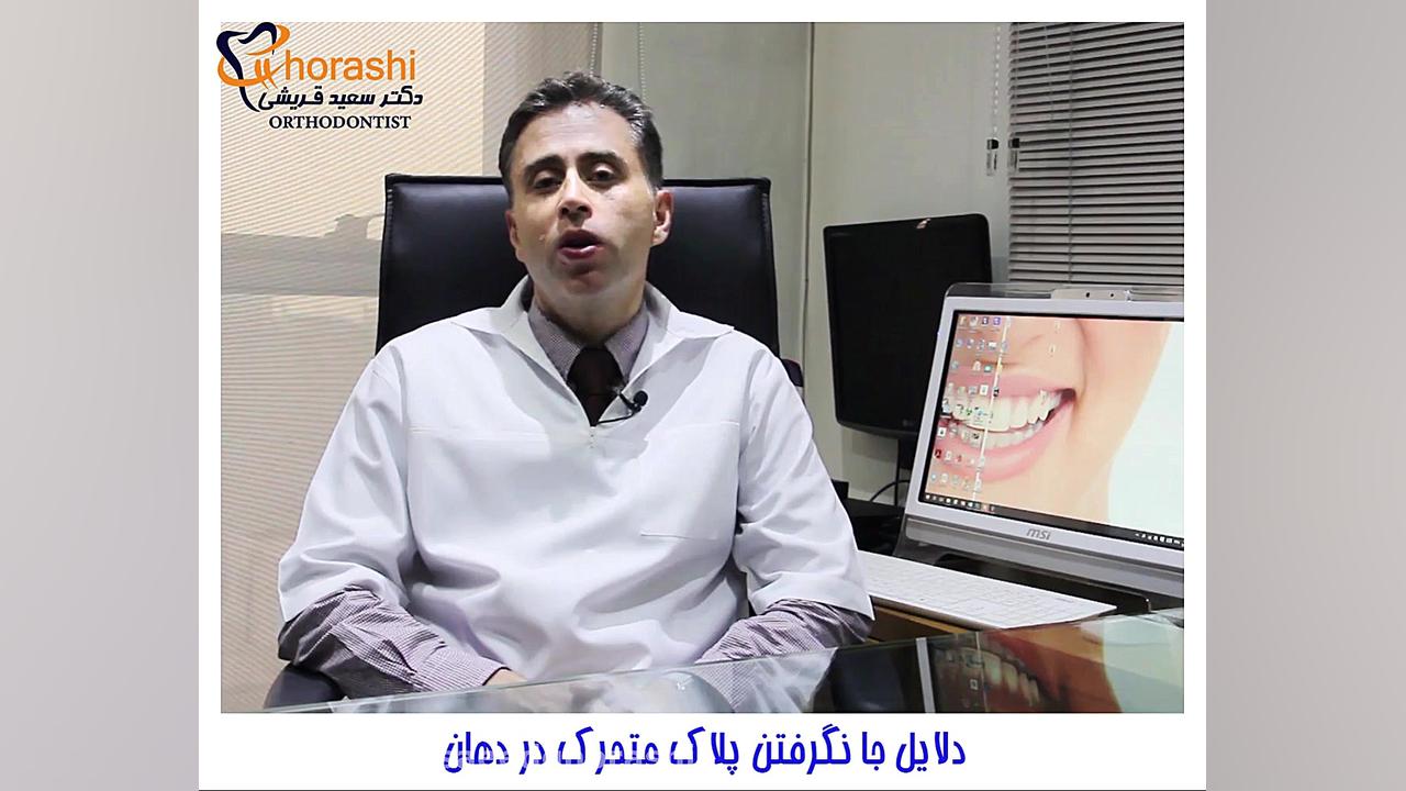 دلایل جا نگرفتن پلاک متحرک در دهان- دکتر سعید قریشی دکتر سعید قریشی