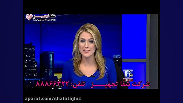 آراف فرکشنال فرکتورا در رسانه ها میکروالکترود آرایه‌ای