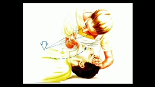 آموزش احیاء قلبی ریوی CPR بلیچینگ دندان