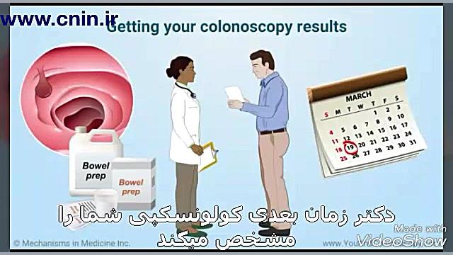 کاربرد کولونوسکوپی در تشخیص و درمان سرطان پروتز دندان
