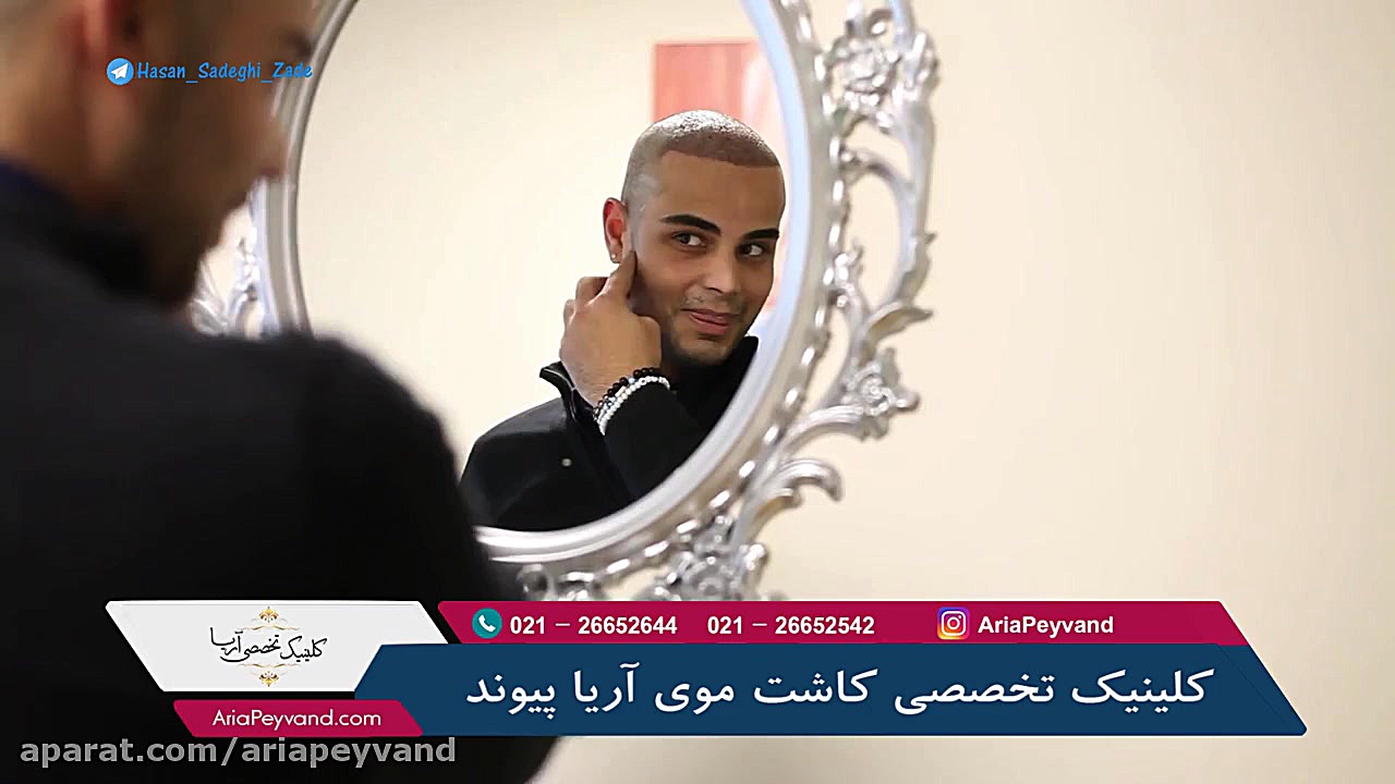 جدیدترین روش کاشت مو - کلینیک آریا بیماری هموگلوبین S