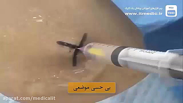 تب مایع آسیت لیزر صورت